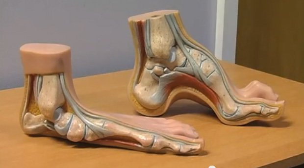 A-Footprint: Europe's foot problems 3D printing TCT Magazine